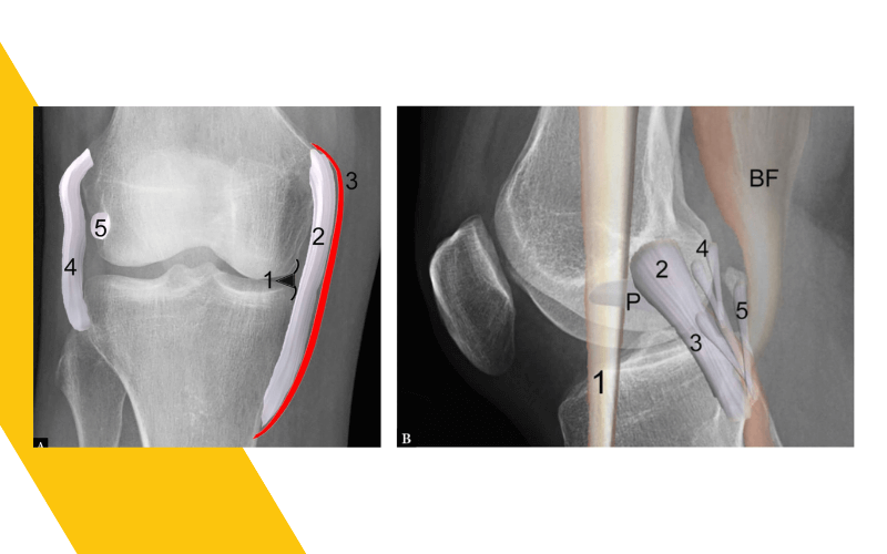 7. Evaluacion rodilla ecografia1.png